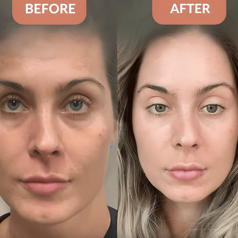 Rovina Astaxanthin 12mg Softgels